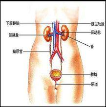 泌尿系感染的原因