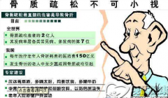 预防骨质疏松的注意